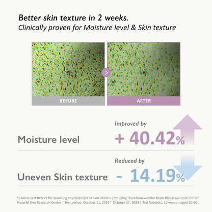 Haruharu Wonder - Black Rice Hyaluronic Toner  (150ml)