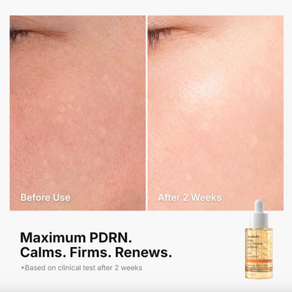 Genabelle PDRN VITA Toning Ampoule