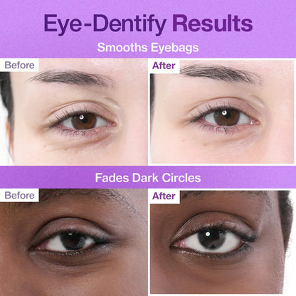 No.9 NAD Collagen Under Eye Patches - Eye Patches with Collagen & 50 Peptides